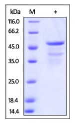 Human CD99, Fc Tag on SDS-PAGE under reducing (R) condition. The gel was stained overnight with Coomassie Blue. The purity of the protein is greater than 90%.